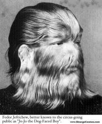 jo-jo the dog-faced boy.jpg